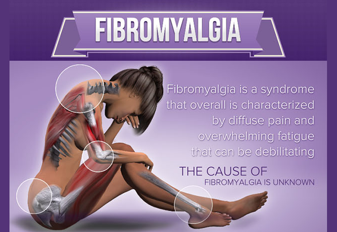 Fibromyalgia disorder